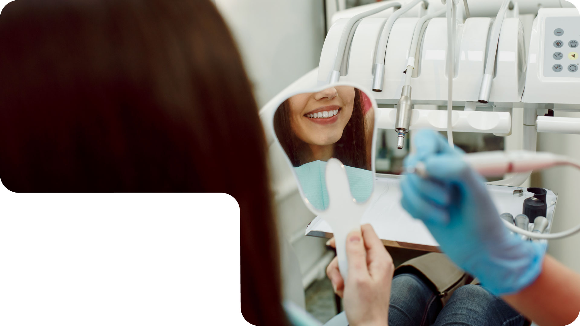 Faccette estetiche Roma